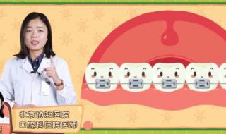 北京那个三甲医院牙科好 北京协和医院口腔科